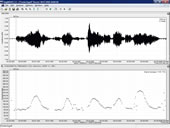 lingWAVES Voice Analysis